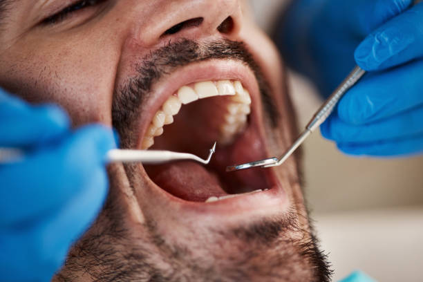 Best Dental Abscess Treatment in Tonto Basin, AZ